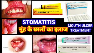 Stomatitis  मुंह के छाले का इलाज  Mouth Ulcer Treatment  Stomatitis In Hindi Muh K Chale Ka Ilaj [upl. by Natfa]