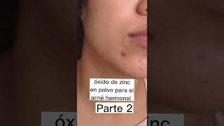 OXIDO DE ZINC para acné manchas y dermatitis infantil [upl. by Leunammi972]