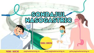 Sondajul nasogastric Tehnica AMG [upl. by Idok]