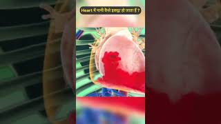 हार्ट में पानी कैसे इकट्ठा हो जाता हैं  fluid in heart pericardialeffusion vidyudabhi [upl. by Meara755]