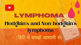 Lymphoma लिम्फोमा Hodgkins and Nonhodgkins lymhoma क्या होता है इसके लक्षण तथा उपचार [upl. by Nnylahs]