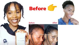 Extreme Hair Growth  Products for Extreme Hair Growth [upl. by Mita]