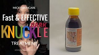 Fade Off Dark Knuckles Fast amp Effective  Fongicide Natural Light  Dark Knuckles Treatment [upl. by Jsandye950]