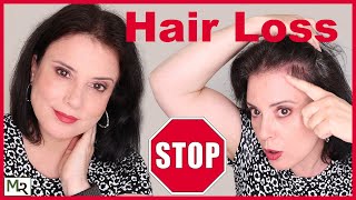 Hair Loss Dermatologist Shares What Causes it amp the Best Treatments Minoxidil amp More [upl. by Stover705]