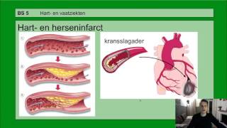 Basisstof 5 Hart en vaatziekten [upl. by Verile829]