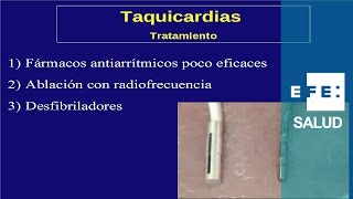 Tratamiento de las arritmias de taquicardia fármacos ablación y desfibrilador [upl. by Silrak744]