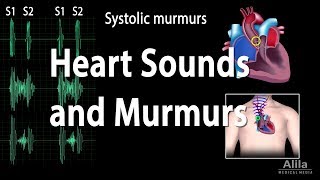 Heart Sounds and Heart Murmurs Animation [upl. by Kinsman]