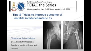 TOTAC2021 Ep2 Part 410 Tips amp Tricks for unstable intertrochanteric Fx By DrTheerachai CMU [upl. by Annawit377]