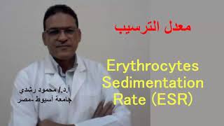 Erythrocytes Sedimentation rate ESR  معدل ترسيب خلايا الدم الحمراء [upl. by Yorled]