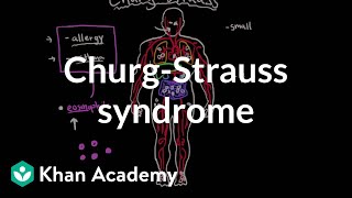 ChurgStrauss syndrome  Circulatory System and Disease  NCLEXRN  Khan Academy [upl. by Allehs]