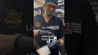 LIP FILLERSlipfillerlipfillerslipaugmentationdranirbanghosh [upl. by Arym]