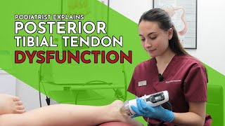 Posterior Tibial Tendon Dysfunction PTTD  Chantelle Crossland Singapore Podiatrist [upl. by Thrasher]