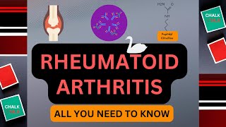 RHEUMATOID ARTHRITIS ALL YOU NEED TO KNOW [upl. by Yentirb]