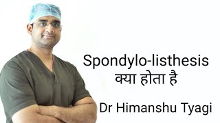 spondylolisthesis क्या होता है  What is spondylolisthesis [upl. by Marika26]