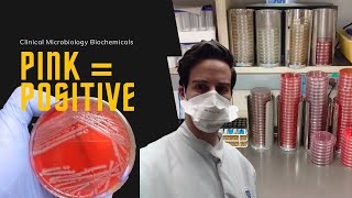 Microbiology Indole Test for E coli [upl. by Vowel667]