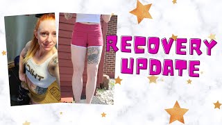 Bone Graft Surgery Update 1  Physical Therapy for Knee [upl. by Muffin]