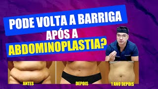 QUEM FAZ ABDOMINOPLASTIA PODE VOLTAR A TER BARRIGA I Cirurgia Plástica [upl. by Elorak879]