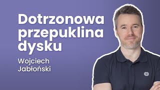 Dotrzonowa przepuklina dysku  32 Radiologia [upl. by Antoinetta132]