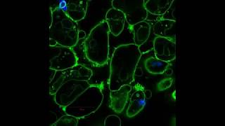 Endocytic Markers Associated with the Internalization and Processing of Aspergillus fumigatus [upl. by Furtek]