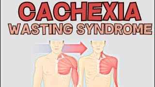 Cachexia  Wasting Syndrome  Explained [upl. by Shannon609]