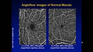 OCT and Fundus Imaging An Update with Dr Jerome Sherman [upl. by Maddalena]