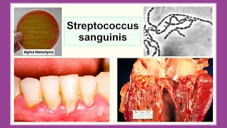 Streptococcus sanguinis [upl. by Diver206]