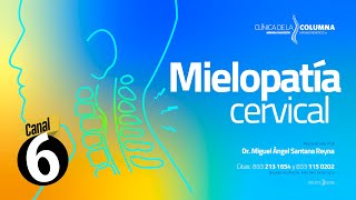 Mielopatía Cervical Espondilótica CSM  Clínica de la Columna [upl. by Meryl]