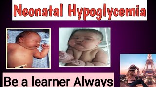 Neonatal Hypoglycemia [upl. by Attenhoj]