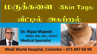 மருக்களை வீட்டில் இலகுவாக அகற்றுவதெப்படி  Skin Tags  Remove Skin Tags at Home  Dr  Riyaz Majeed [upl. by Adamsen]