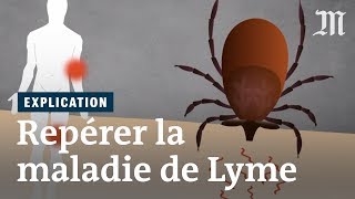 Maladie de Lyme  comment la repérer [upl. by Kendy]