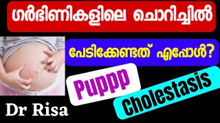 Pregnancy Time Skin Itching Malayalam  Puppp rash  Cholestasis [upl. by Aggappera]