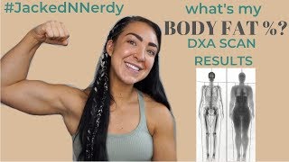 Whats my BODY FAT PERCENT After a 40lb Weight Loss  DXA Scan Results [upl. by Dorcea]