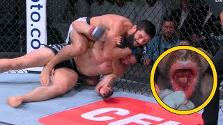 Khamzat Chimaev Shatters Robert Whittakers Jaw at UFC 308  Doctor Explains [upl. by Kcirdot656]