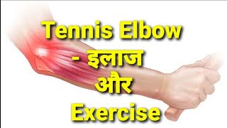 Tennis Elbow Treatment इलाज amp Exercisestretchesphysiotherapy [upl. by Andrel108]