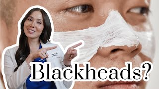 How To Remove Blackheads And Whiteheads On Face Easy 122 ✦ Dr Laelia ✦ [upl. by Rento302]