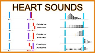 Heart Sounds Murmurs and Splitting [upl. by Asilej]