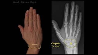 Anatomy of Hand XraysRevised [upl. by Harpole]