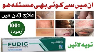 FUDIC FUDIC fusidic acid cream uses in UrduFUDIC CREAMhow to use FUDIC CREAM in Urdu [upl. by Nealon]