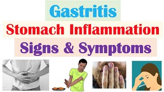 Gastritis Stomach Inflammation Signs amp Symptoms Complications amp Why They Occur [upl. by Orton]