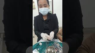 hepatitis amp epilepsy mananagement in dentistryalveoloplastyarunachal oral surgeon [upl. by Aihsaei]