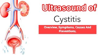 Treatment of Cystitis  Ultrasound of bladder cystitis  Medicine information  Medical knowledge [upl. by Angell710]