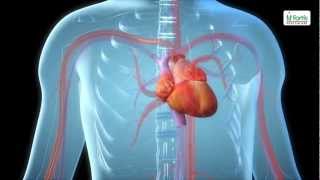 Angioplasty Procedure Animation Video [upl. by Farr]