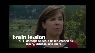 Brain Awareness Video Contest Three Lesions Three Lives [upl. by Liberati]