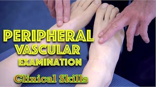 Peripheral Vascular Examination  Clinical Skills  Dr Gill [upl. by Fronia336]