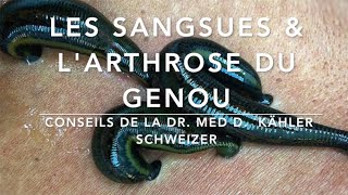 Les sangsues amp larthrose du genou Conseils de la Dr Med Kähler Schweizer Par M DRAKE [upl. by Moreta]