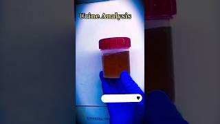 Urine Analysis Complete  Urine RE  bacteria microscope science 1millionviews viral shorts [upl. by Zigmund]