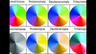 Red weak color blindness [upl. by Saltzman]