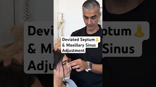 Deviated Septum amp Maxillary Sinus Adjustment chiropractic shorts [upl. by Patrica732]