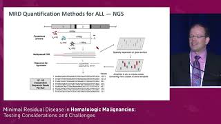 Acute Lymphocytic Leukemia Overview of Latest Guidelines in Hematological Malignancies [upl. by Analos]