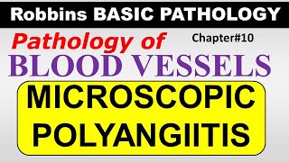 Ch10  MICROSCOPIC POLYANGIITIS  Blood Vessel Pathology  Robbins Lectures [upl. by Garvin585]